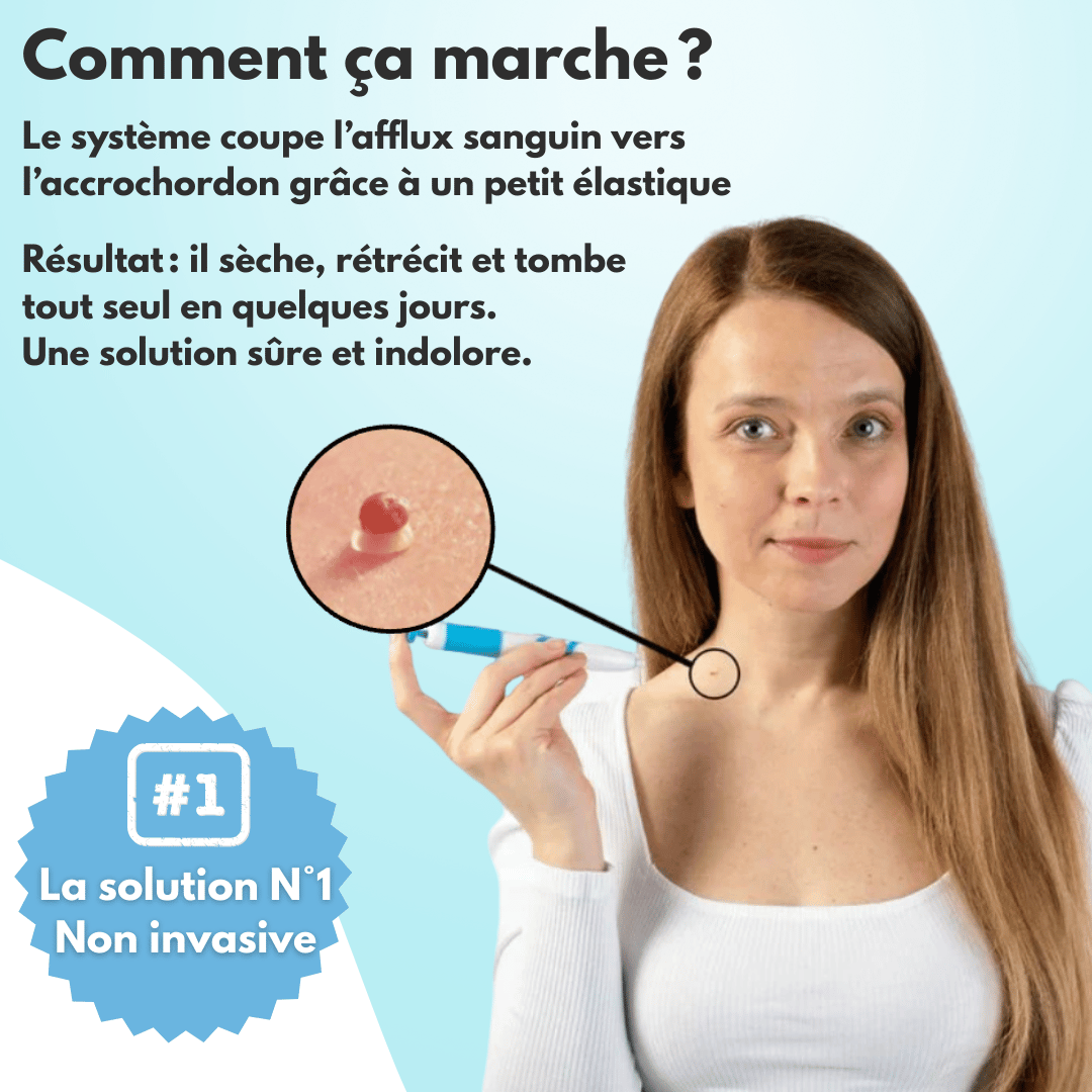 DermaSkin Pro™ - Adieu les acrochordons
