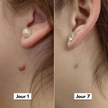 Avis client dermaskin pro